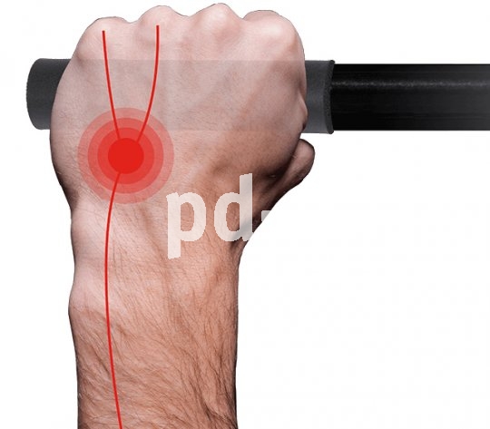 Draufsicht auf eine Hand am Fahrradlenker, überlagert von grafischen Elementen, die Nervenbahnen und einen kritischen Punkt repräsentieren.