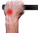 Draufsicht auf eine Hand am Fahrradlenker, überlagert von grafischen Elementen, die Nervenbahnen und einen kritischen Punkt repräsentieren.